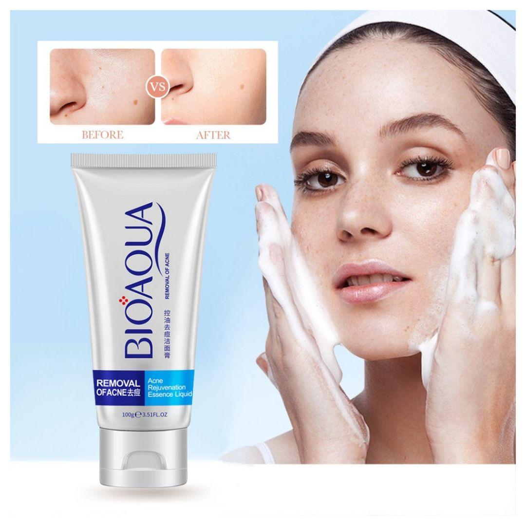 Limpiador Facial Anti acné BIOAQUA Formula Francesa - El Baúl de mamá