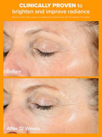 C15 Vitamina C Super Booster 20ml - Paula's Choice