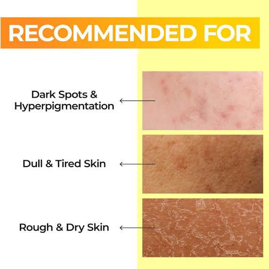 Numbuzin 5 Vitamin Boosting Toner Anti Manchas y Vitaminas 200ml - El Baúl de Mamá