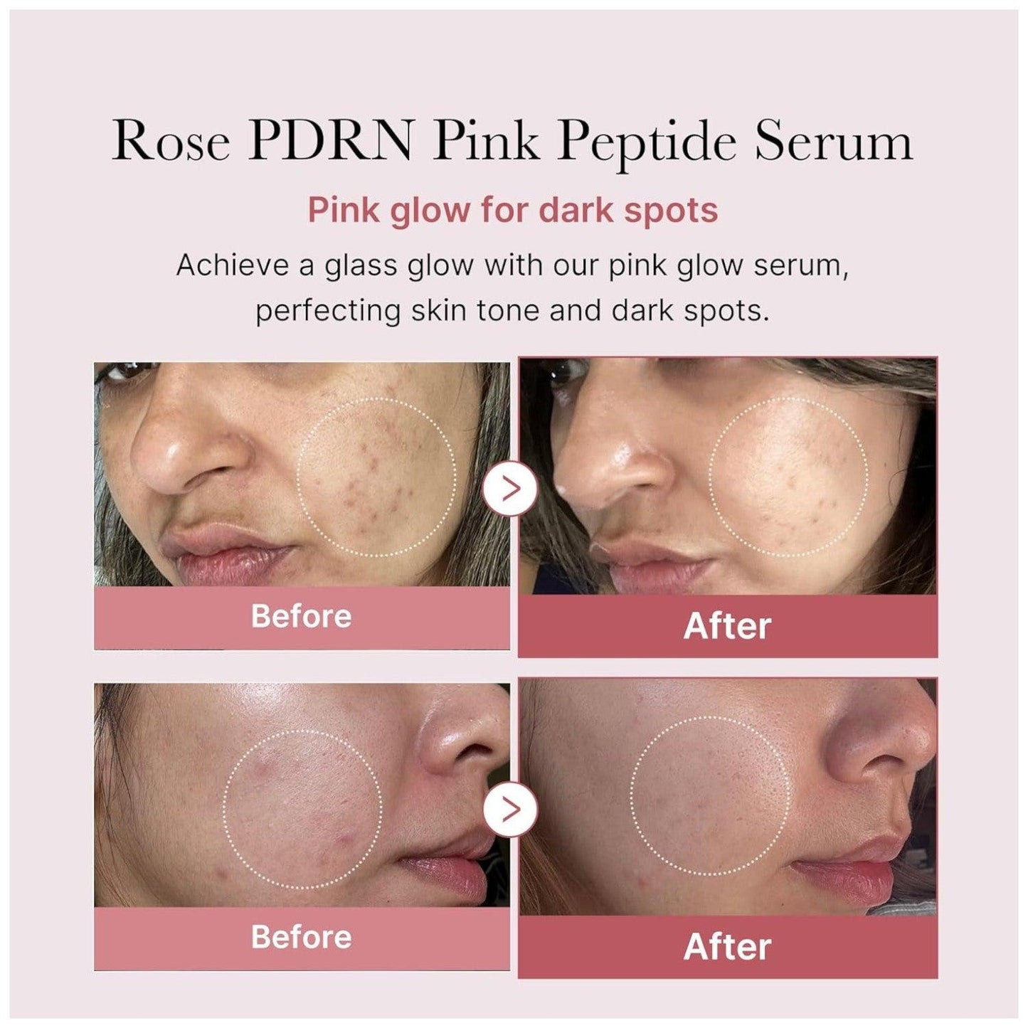 Medicube - PDRN Pink Peptide Serum 30ml - El Baúl de Mamá