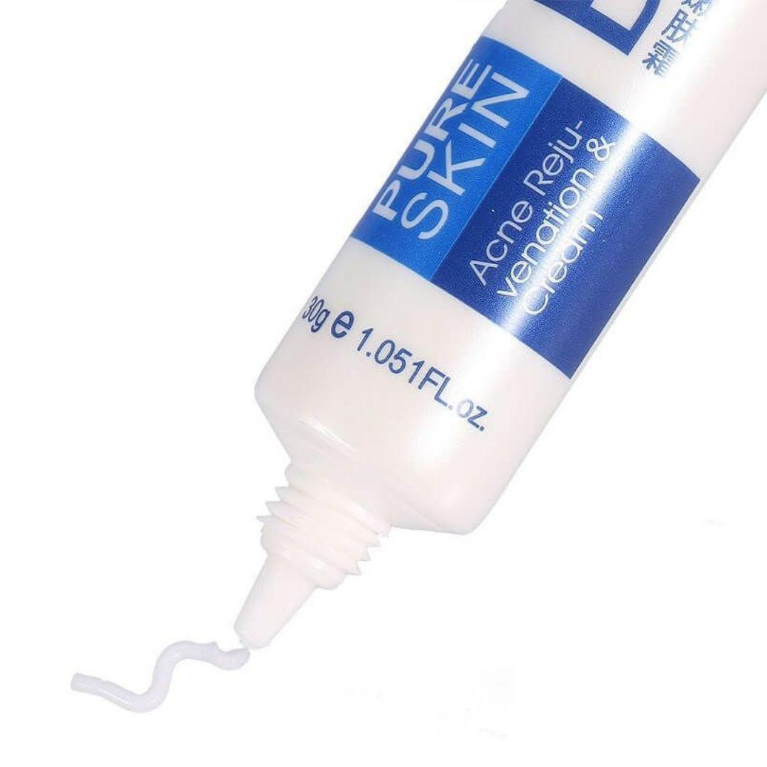 Crema para el Control de Oleosidad y Acné - BIOAQUA - El Baúl de mamá