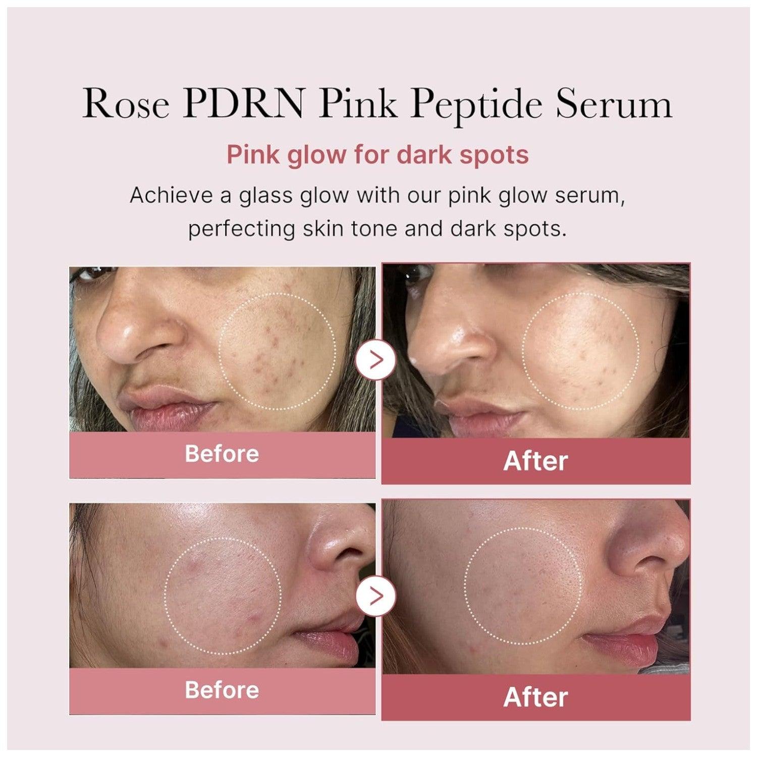 Medicube - PDRN Pink Peptide Serum 30ml - El Baúl de Mamá