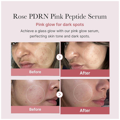 Medicube - PDRN Pink Peptide Serum 30ml - El Baúl de Mamá