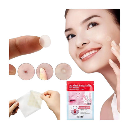 Parches para Acne x 24 - El Baúl de Mamá